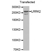 Leucine-Rich Repeat Serine/Threonine-Protein Kinase 2 (LRRK2) Antibody