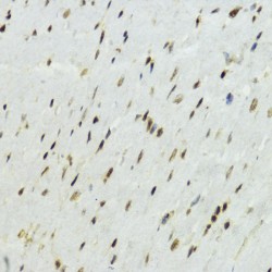 Histone H3K27AC Antibody