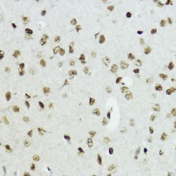 Histone H3K27AC Antibody