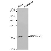 Western blot analysis of extracts of various cell lines, using Trimethyl-Histone H3-K14 antibody (abx000037).