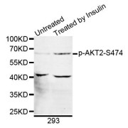 Western blot analysis of extracts of 293 cells, using Phospho-AKT2-S474 antibody (abx000095).