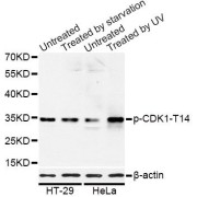 Western blot analysis of extracts of HT-29 and HeLa cells, using Phospho-CDK1-T14 antibody (abx000104) at 1/1000 dilution. HT-29 cells were treated by serum-starvation overnight. HeLa cells were treated by UV for 15-30 minutes.