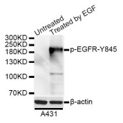 Western blot analysis of extracts of A-431 cells, using Phospho-EGFR-Y845 antibody (abx000112) at 1/1000 dilution. A431 cells were treated by EGF (100ng/ml) for 30 minutes after serum-starvation overnight.