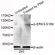 Western blot analysis of extracts of 293 cells, using Phospho-ERK3-S189 antibody (abx000136) at 1/1000 dilution. 293 cells were treated by PMA/TPA (200nM) for 30 minutes after serum-starvation overnight.