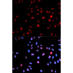 p53 Phospho-Ser15 (p53 pS15) Antibody