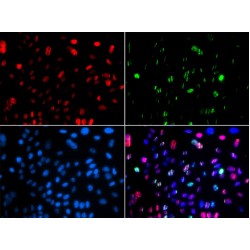 p53 Phospho-Ser15 (p53 pS15) Antibody