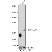 Western blot analysis of extracts of A-431 cells, using Phospho-RAC1/2/3-S71 antibody (1/1000 dilution). A431 cells were treated by EGF (25 µg/ml) at 37 °C for 30 minutes after serum-starvation overnight.