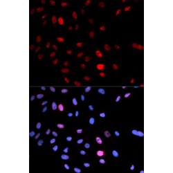 SMC1A (pS957) Antibody