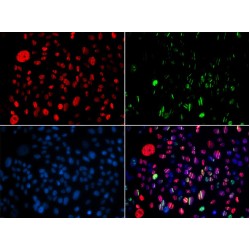 SMC1A (pS957) Antibody