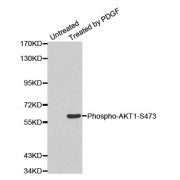 Western blot analysis of extracts from NIH/3T3 using Phospho-AKT1-S473 antibody (abx000192).