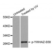 Western blot analysis of extracts from HeLa cells, using Phospho-YWHAZ-S58 antibody (abx000247).