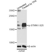 Western blot analysis of extracts of Jurkat cells, using Phospho-STMN1-S25 antibody (abx000272) at 1/2000 dilution. Jurkat cells were treated by PMA/TPA (200nM) for 10 minutes.