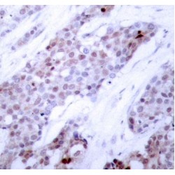 ATF4 (pS245) Antibody