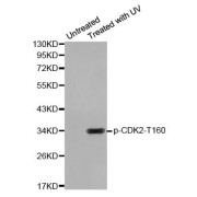 Western blot analysis of extracts from HeLa cells using Phospho-CDK2-T160 antibody (abx000373).