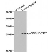 Western blot analysis of extracts from HeLa cells, using Phospho-CDKN1B-T187 antibody (abx000376).