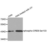 Western blot analysis of extracts from HeLa cells untreated or treated with UV, using Phospho-CREB1-S133 antibody (abx000381).