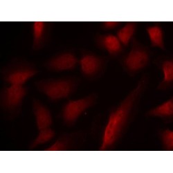 GATA1 (pS310) Antibody