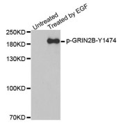 Western blot analysis of extracts from A431 cells, using Phospho-GRIN2B-Y1474 antibody (abx000405).