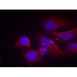 Glutamate Receptor Ionotropic, NMDA 2B Phospho-Tyr1474 (GRIN2B pY1474) Antibody