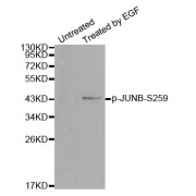 Western blot analysis of extracts from HT29 cells, using Phospho-JUNB-S259 antibody (abx000423).