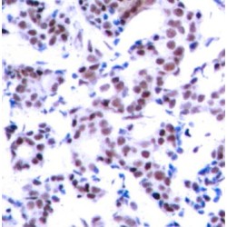 JUNB (pS259) Antibody