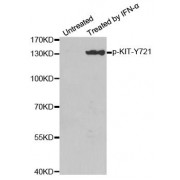 Western blot analysis of extracts from HeLa cells, using Phospho-KIT-Y721 antibody (abx000432).