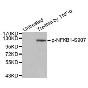 Western blot analysis of extract from HeLa cells, using phospho-NFKB1-S907 antibody (abx000463).