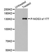 Western blot analysis of extracts of various cell lines, using Phospho-NOS3-S1177 antibody (abx000468).