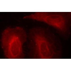 PDPK1 (pS241) Antibody