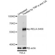 Western blot analysis of extracts of HeLa cells, using Phospho-RELA-S468 antibody (abx000493) at 1/2000 dilution. HeLa cells were treated by TNF-α (20ng/ml) for 30 minutes.