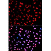 Immunofluorescence analysis of U2OS cells using Phospho-ESPL1-S1126 antibody (abx000516). Blue: DAPI for nuclear staining.