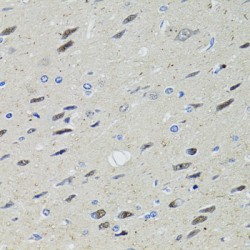 Signal Transducer And Activator of Transcription 1 (STAT1) Antibody