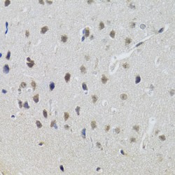 Signal Transducer And Activator of Transcription 1 (STAT1) Antibody