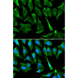 Breast Cancer Type 1 Susceptibility Protein (BRCA1) Antibody