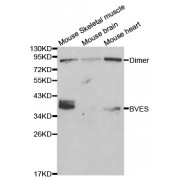 Western blot analysis of extracts of various cell lines, using BVES antibody (abx000601) at 1/1000 dilution.
