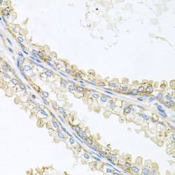 Prominin 1 (PROM1) Antibody