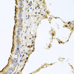 Prominin 1 (PROM1) Antibody