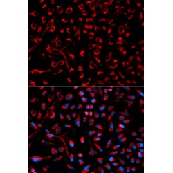 Docking Protein 4 (DOK4) Antibody