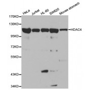 Western blot analysis of extracts of various cell lines, using HDAC4 antibody (abx000624) at 1/1000 dilution.