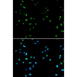 Histone Deacetylase 4 (HDAC4) Antibody