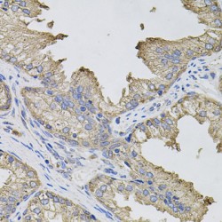 Interferon Gamma (IFNG) Antibody