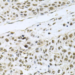 Induced Myeloid Leukemia Cell Differentiation Protein (MCL1) Antibody