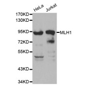 Western blot analysis of extracts of various cell lines, using MLH1 antibody (abx000639) at 1/1000 dilution.