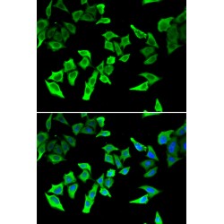 DNA Mismatch Repair Protein Mlh1 (MLH1) Antibody