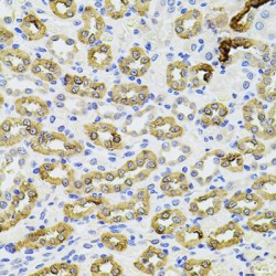 Phosphatidylinositol-4,5-Bisphosphate 3-Kinase Catalytic Subunit Alpha Isoform (PIK3CA) Antibody