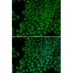 RNA Polymerase I Subunit C (POLR1C) Antibody