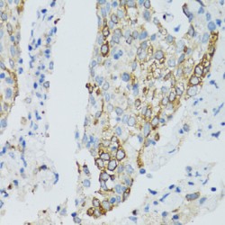 Sirtuin 2 (SIRT2) Antibody