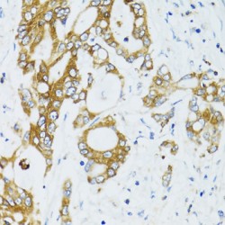 Sirtuin 2 (SIRT2) Antibody