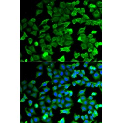 Sirtuin 2 (SIRT2) Antibody