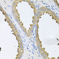 Tyrosine-Protein Kinase ABL1 (ABL1) Antibody